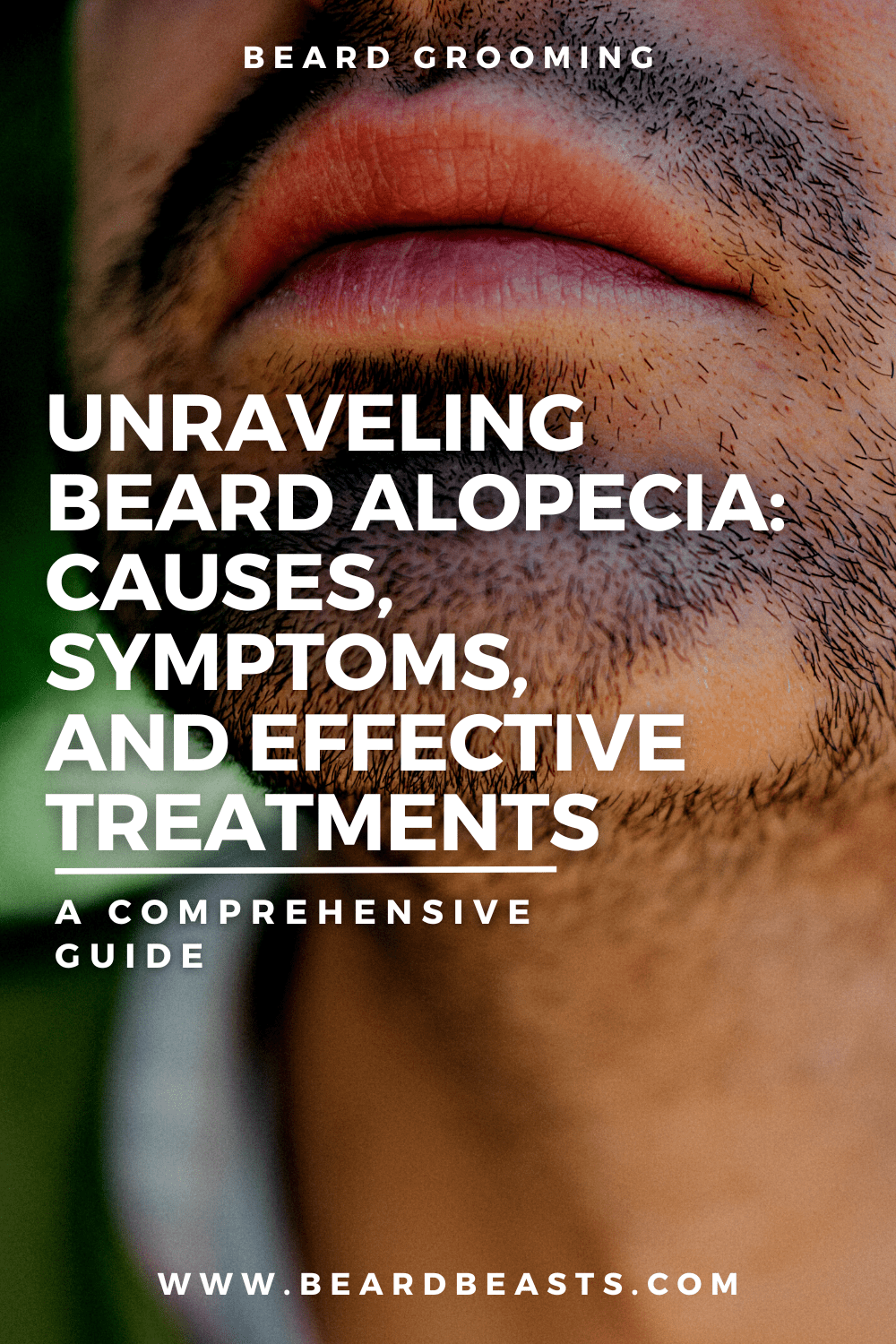 Unraveling Beard Alopecia: Causes, Symptoms, and Effective Treatments Pinterest Pin